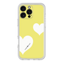 プレミアムパネル［ Two Hearts - Yellow ］