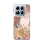 スリムプロテクションケース［ Champagne pink ］