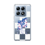 スリムプロテクションケース［ 音街ウナ - コラージュ ］