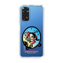 スリムプロテクションケース［ アクビガール - オーバル ］