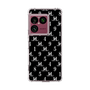 スリムプロテクションケース［ Chell classy - Monogram - Black ］