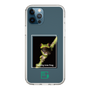 スリムプロテクションケース［ Green Future Project - Gliding tree frog ］