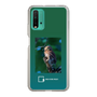 スリムプロテクションケース［ Green Future Project - Ferruginous Pygmy Owl ］