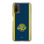スリムプロテクションケース［ B.LEAGUE - 宇都宮ブレックス - ロゴデザイン ］