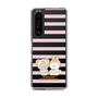 スリムプロテクションケース［ mofmofriends - ストライプ ］