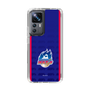 スリムプロテクションケース［ B.LEAGUE - 青森ワッツ - ロゴデザイン ］