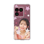スリムプロテクションケース［ ジャストプロ - 小島菜々恵 - スター ］