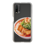 スリムプロテクションケース［ 鯱輪 - 旨辛にんにくラーメン2 ］