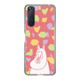 スリムプロテクションケース［ MOOMIN - Blushing face - color ］