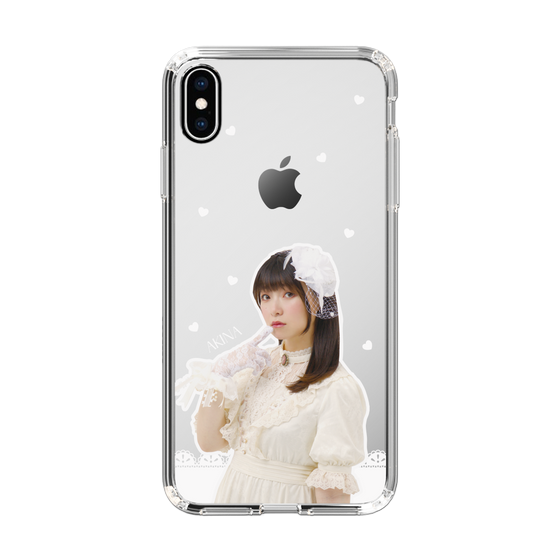 スリムプロテクションケース［ 法元明菜 - レース ］