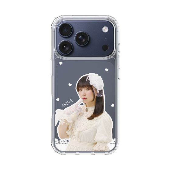 スリムプロテクションケース［ 法元明菜 - レース ］