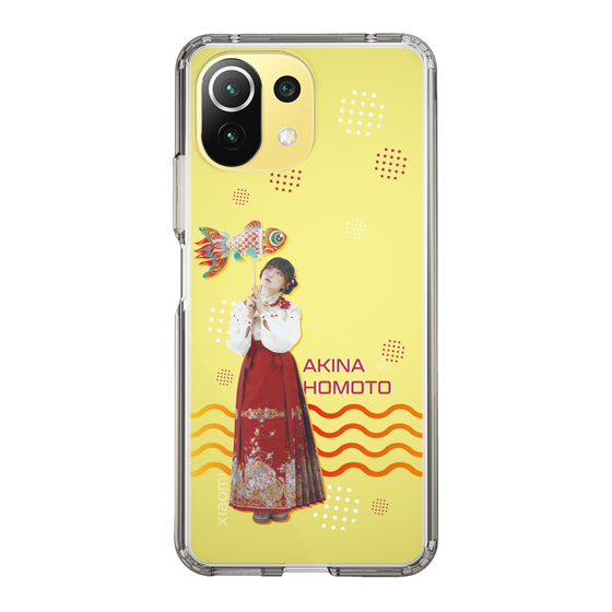 スリムプロテクションケース［ 法元明菜 - 金魚 ］