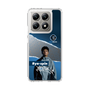 スリムプロテクションケース［ D.LEAGUE - KOSÉ 8ROCKS - Ryo-spin ］