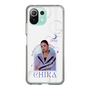 スリムプロテクションケース［ D.LEAGUE - Medical Concierge I'moon - CHIKA ］