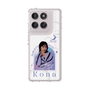 スリムプロテクションケース［ D.LEAGUE - Medical Concierge I'moon - Kona ］