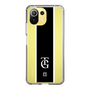スリムプロテクションケース［ 読売ジャイアンツ - TGマーク ］