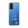 スリムプロテクションケース［ スマートフォンケース<書き下ろしサインver.>ホワイト - YUKI ］