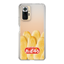 スリムプロテクションケース［ ハッピーターン - ハッピーターンがいっぱい ］