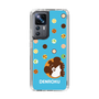 スリムプロテクションケース［ でん六 - 豆菓子 ］
