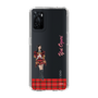 スリムプロテクションケース［ 【AKB48 THREE CONCEPTS LIVE開催記念コラボグッズ】 - 小栗 有以 ］