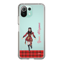 スリムプロテクションケース［ 【AKB48 THREE CONCEPTS LIVE開催記念コラボグッズ】 - 秋山 由奈 ］
