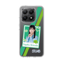 スリムプロテクションケース［ STU48 - インスタントフォト風デザイン - 島田紗香 ］