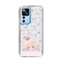 スリムプロテクションケース［ ぽちぇ - cream soda ］
