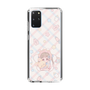 スリムプロテクションケース［ ぽちぇ - baby girl ］