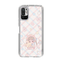 スリムプロテクションケース［ ぽちぇ - baby girl ］