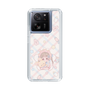 スリムプロテクションケース［ ぽちぇ - baby girl ］
