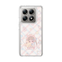 スリムプロテクションケース［ ぽちぇ - baby girl ］