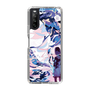 スリムプロテクションケース［ hato - 静かな夢 ］