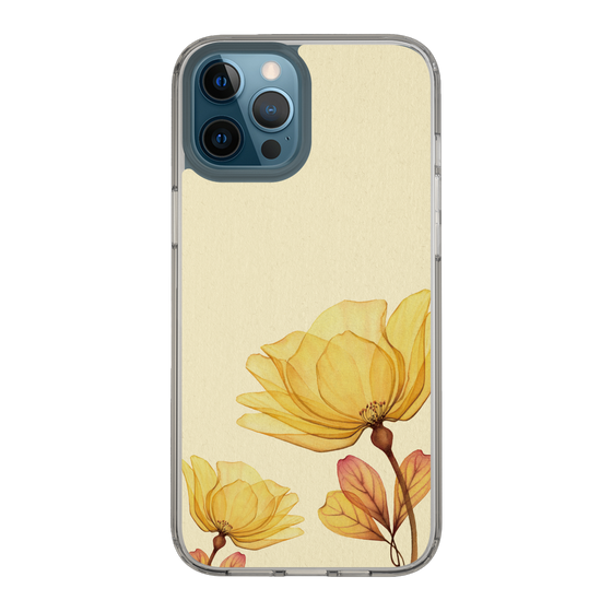 スリムプロテクションケース［ Natural Flower ］