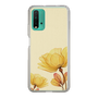 スリムプロテクションケース［ Natural Flower ］