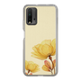 スリムプロテクションケース［ Natural Flower ］