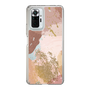 スリムプロテクションケース［ Champagne pink ］