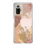スリムプロテクションケース［ Champagne pink ］