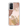 スリムプロテクションケース［ Champagne pink ］