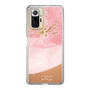 スリムプロテクションケース［ pink layered ］