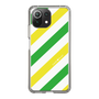 スリムプロテクションケース［ Big Stripe - Green × Yellow ］