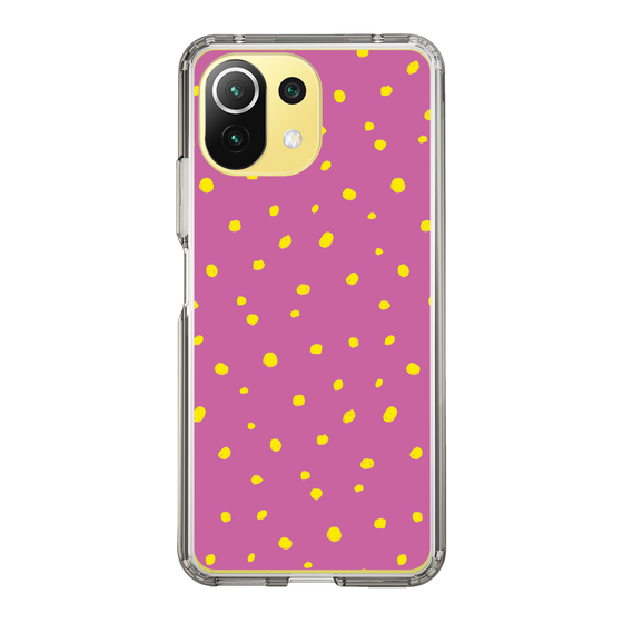 スリムプロテクションケース［ Drawing Dot - Pink ］